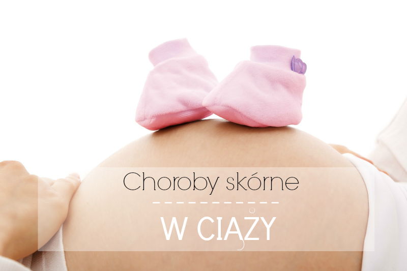 Read more about the article Choroby i problemy skórne w ciąży